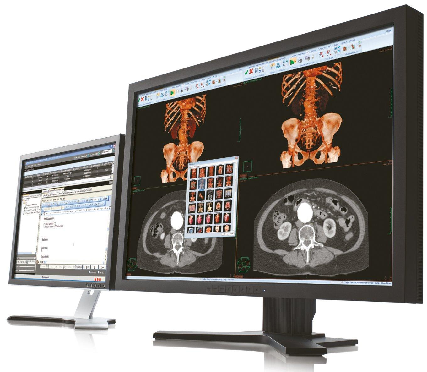 AI in Healthcare
